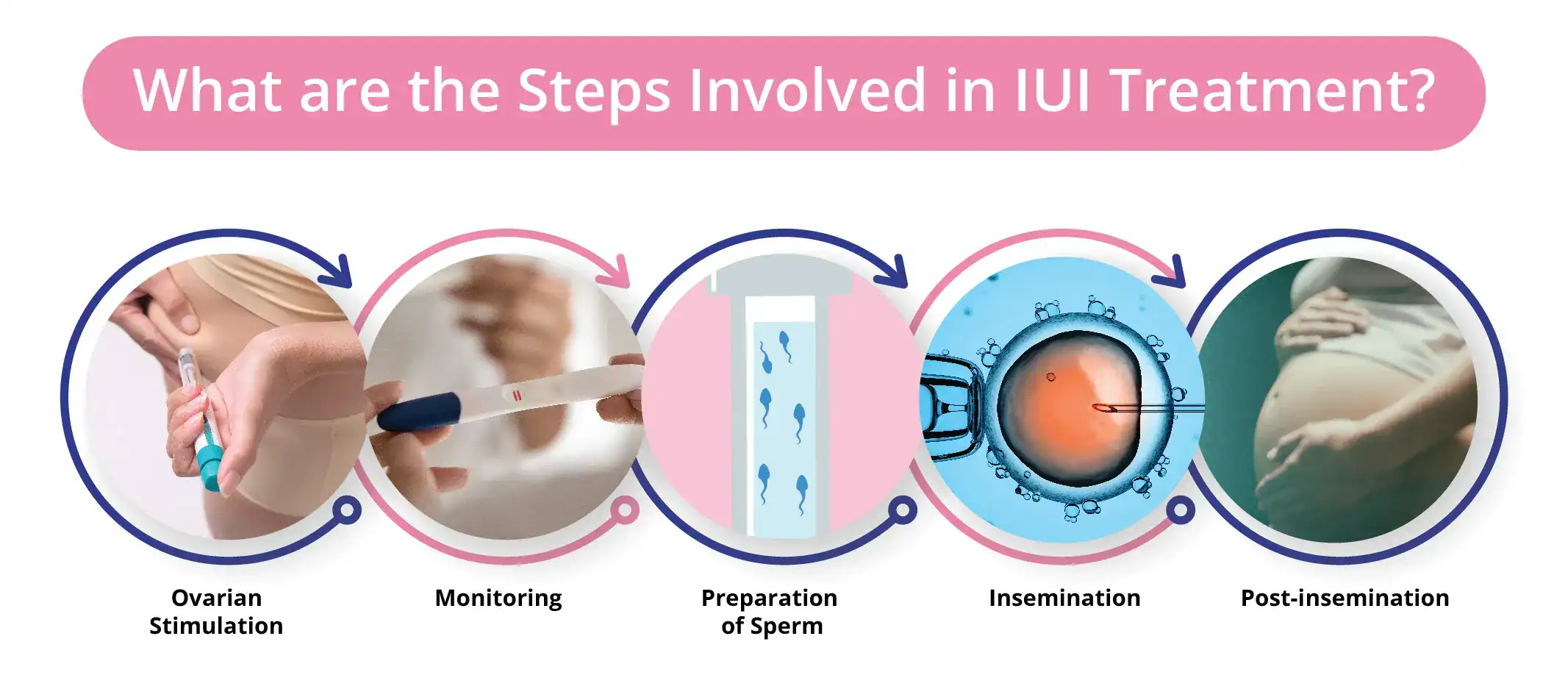 IUI planning and management 1