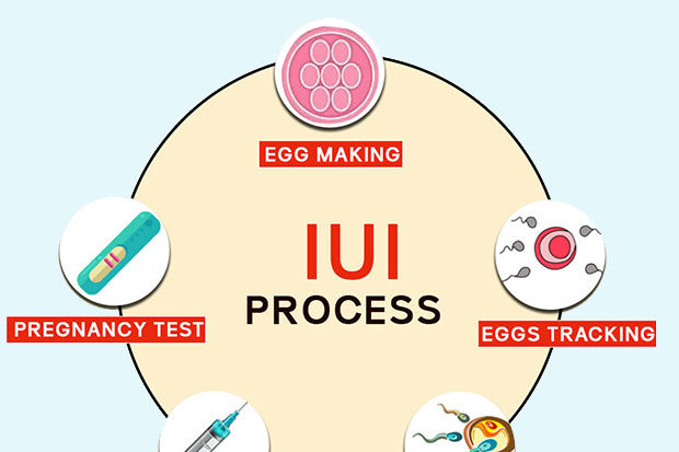 IUI planning and management