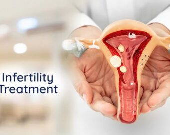 Infertility Treatment