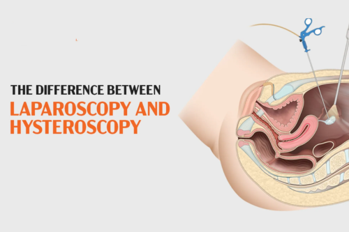 Laparoscopic & Hysteroscopic Surgeries