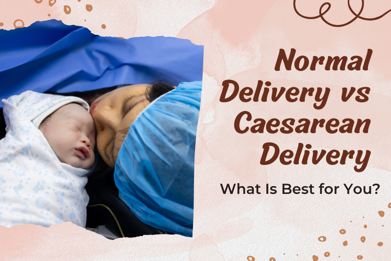 Normal Delivery vs Caesarean Delivery: What Is Best for You?
