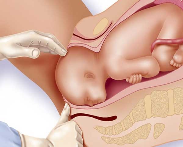 Normal delivery management