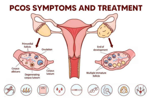 PCOS & Hormonal Disorder Treatment