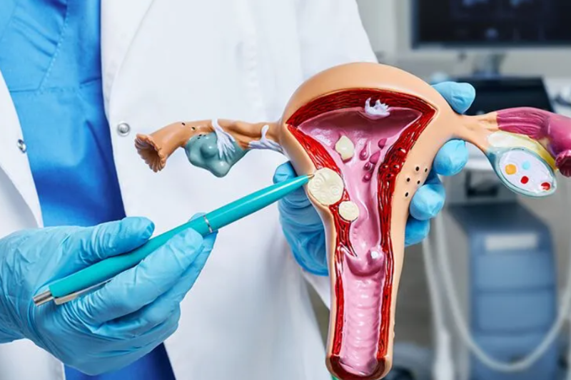 Fibroid treatment planning