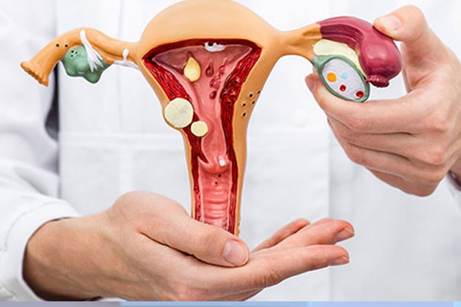 Gynecologic Oncology