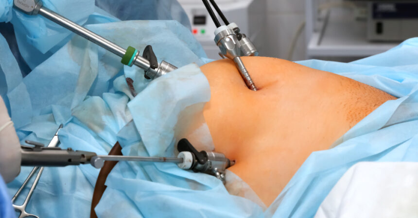 Gynecology and laparoscopy for Balaghat patients in Nagpur