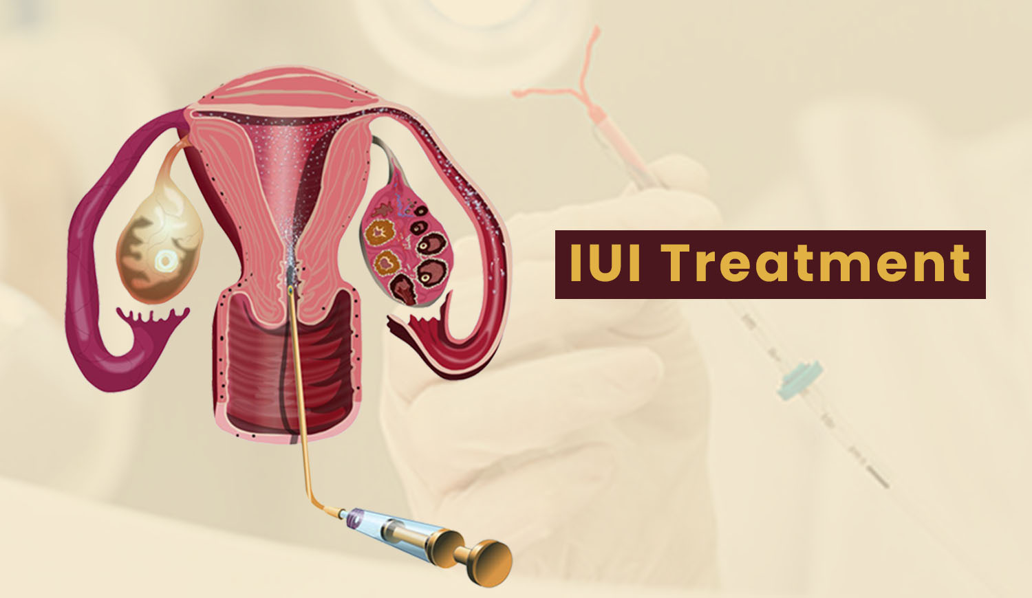 IUI Center Near Me