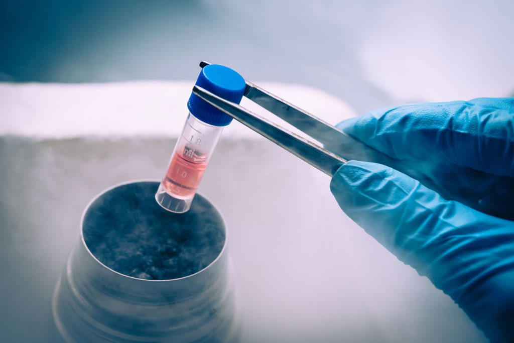 Sperm Freezing In Nagpur