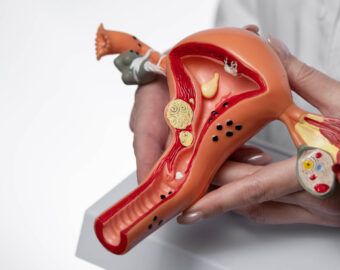 Uterus Removal Specialist In Nagpur